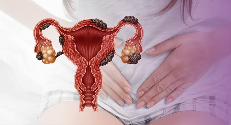 Image do post Médico brasileiro lança livro sobre endometriose e reflete sobre o encontro entre ciência, fé e redes sociais
