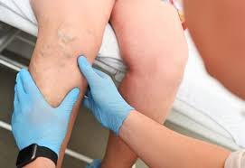 Image do post Saúde vascular masculina precisa começar antes dos sintomas